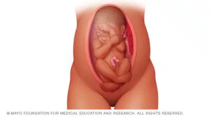 Posição que o bebê pode ficar na gravidez