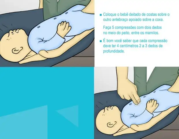 Confira o segundo passo para ajudar um bebê engasgado com leite ou fórmula