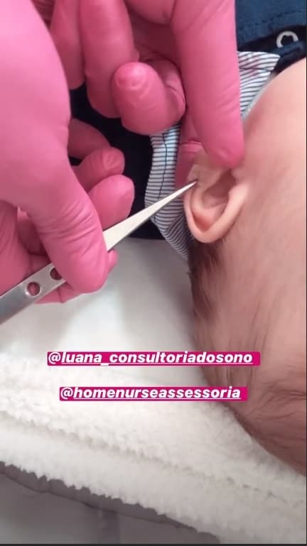 Andressa Ferreira revelou acupuntura do pequeno Bento