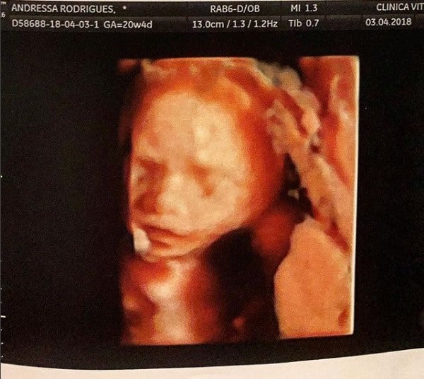 Esse é o ultrassom do futuro bebê de Andressa Suita e Gusttavo Lima