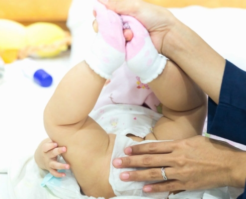 Algumas dicas ajudam a evitar as assaduras no bebê