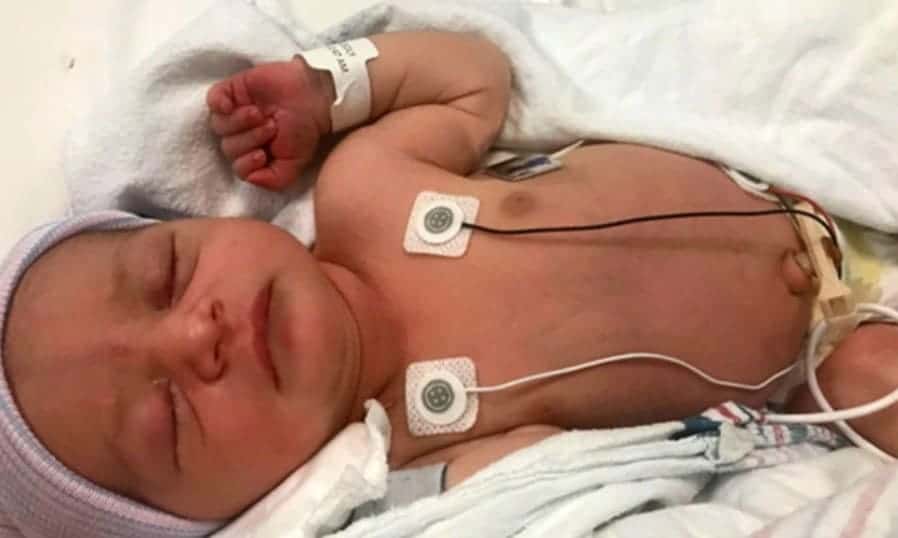 A bebê que teve o topo da cabeça cortado durante o parto