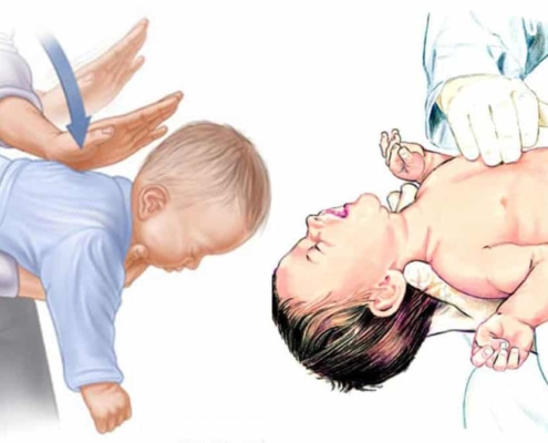 Aprenda a fazer em casos de bebê engasgado