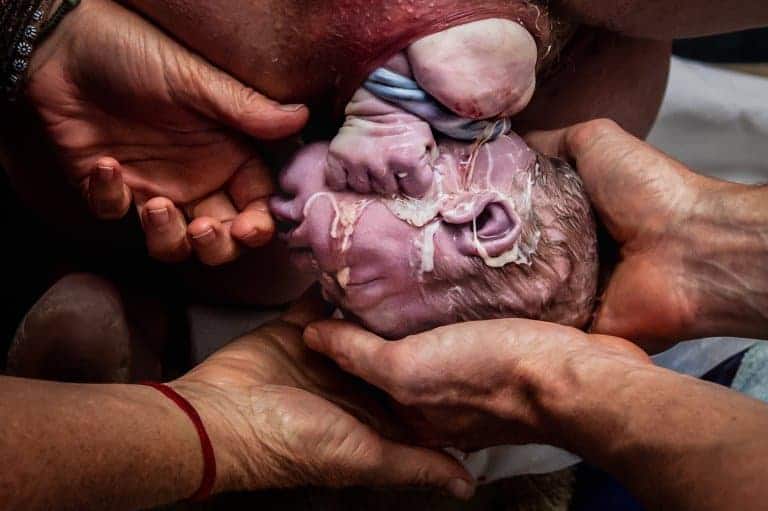 Veja o exato momento em que um nenê nasce