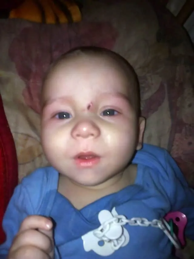 Bebê Zakhar de oito meses morreu após negligência da mãe