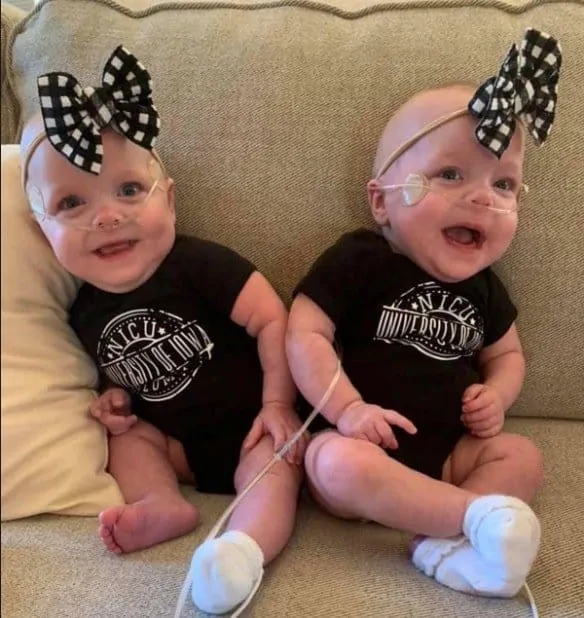 As bebês gêmeas mais prematuras do mundo hoje em dia
