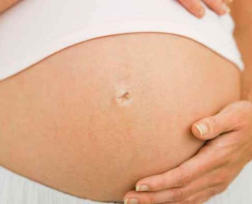 Episiotomia não é algo comum em partos normais