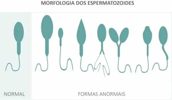 O espermograma analisa a saúde do espermatozoide
