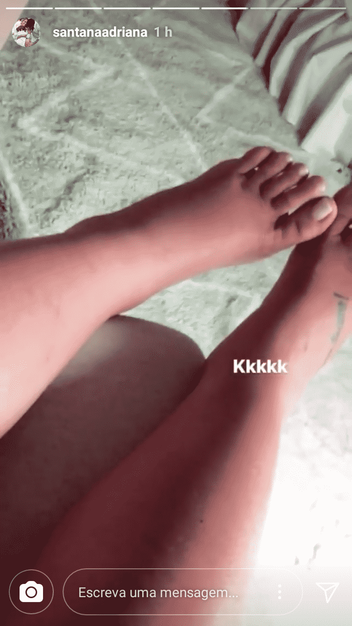 Adriana Sant’Anna postou uma foto das pernas bem inchadas