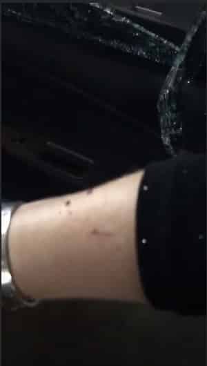 Fabiana Justus compartilhou imagem do seu braço ferido