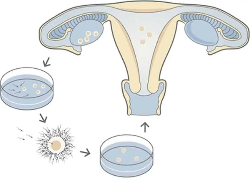 Veja o que acontece na fertilização in vitro