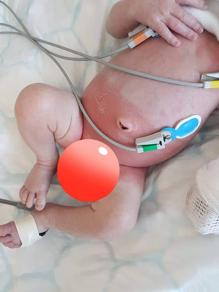 O bebê foi parar no hospital, após os pais mudarem a marca da fralda