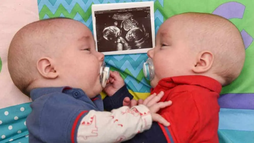 Entenda porque a gravidez de gêmeos é comum na fertilização in vitro