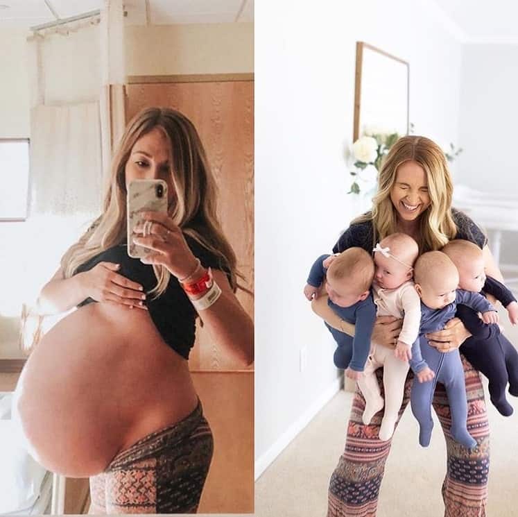 Mãe grávida de quadrigêmeos mostrou como está agora