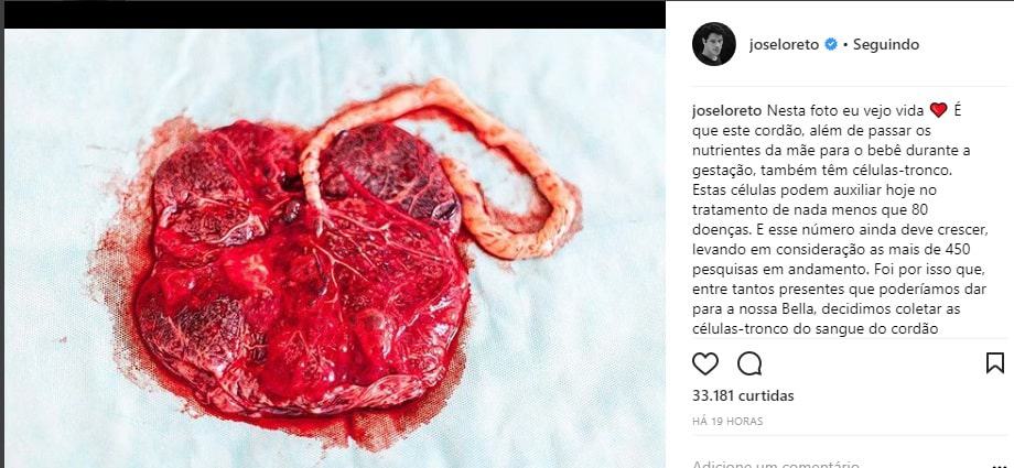 José Loreto compartilhou a imagem da placenta de Débora Nascimento