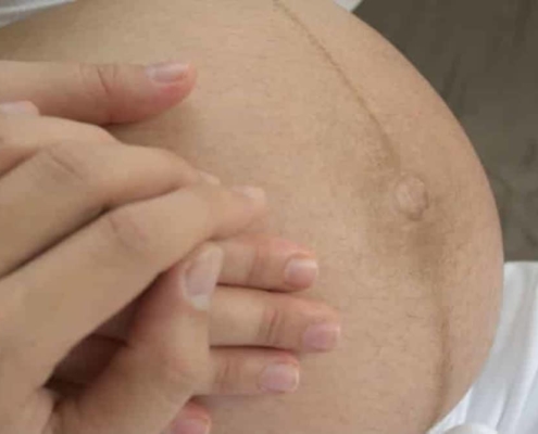 Linea nigra na barriga da gravidez