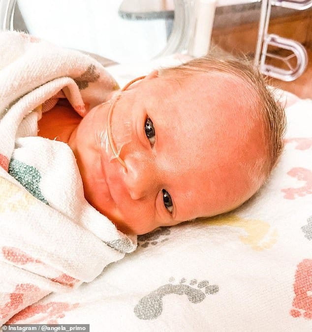 Bebê que nasceu após mãe contrair covid-19