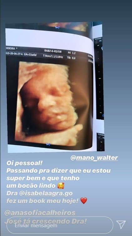 Bebê de Mano Walter no exame de ultrassom