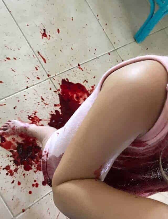 Evie perdeu muito sangue 