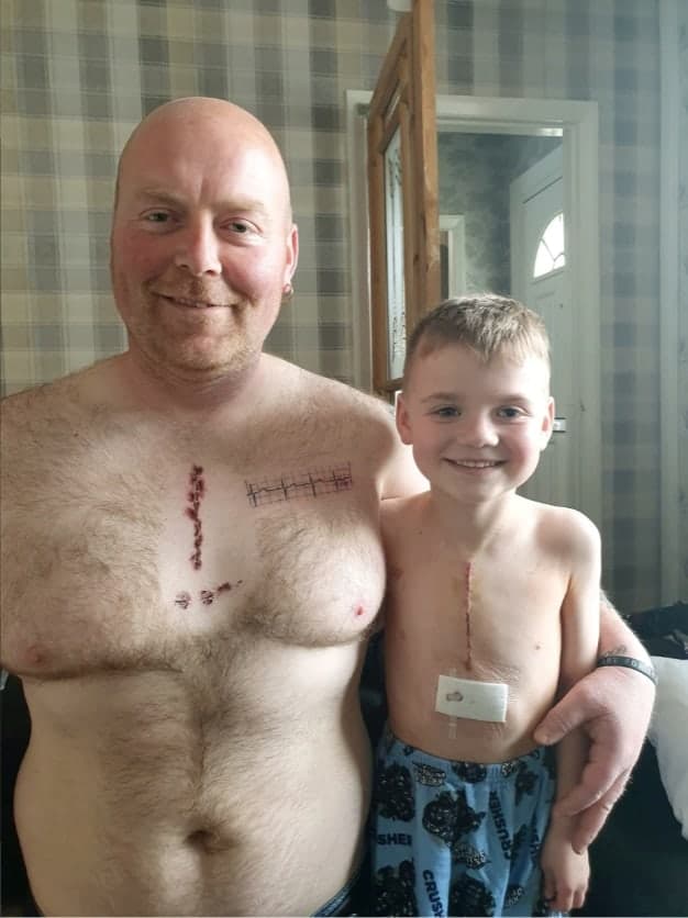 Pai faz tatuagem igual a cicatriz da cirurgia no coração de seu menino