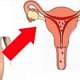 Saiba mais sobre a menstruação após o parto