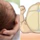 Saiba como cuidar da moleira do bebê