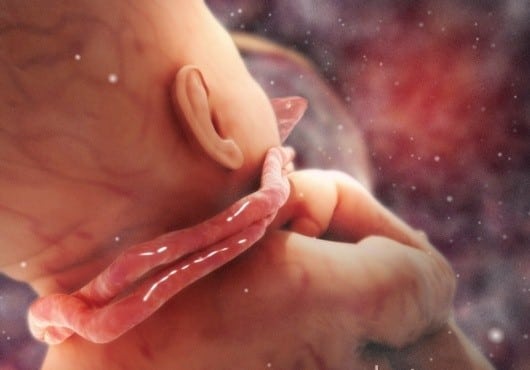 Ilustração mostra o cordão em torno do pescoço do bebê quando ele ainda está na barriga