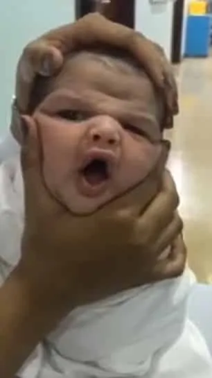 Enfermeiras de maternidade fazem vídeo chocante de recém-nascido