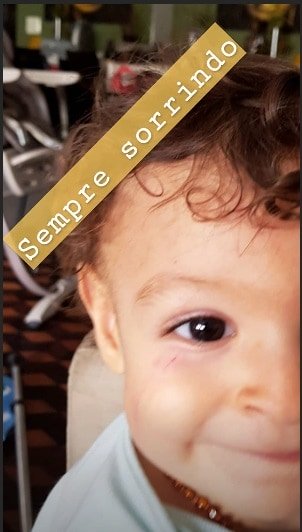 A atriz Sheron Menezzes compartilhou essa imagem do rosto de seu filho Benjamim machucado.