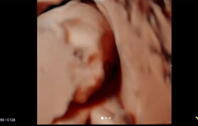 Foto do ultrassom do bebê do cantor Sorocaba e de Biah Rodrigues