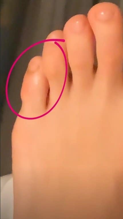 Thaeme mostrou o dedo do pé que foi picado por um bicho no deserto