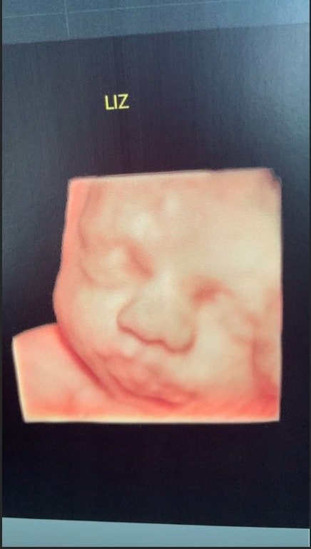 Com uma imagem do ultrassom a cantora Thaeme Mariôto compartilho o rosto de sua bebê
