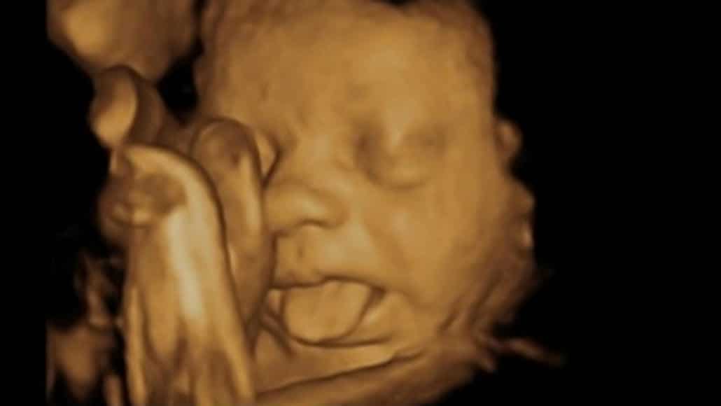 Bebê mostrando a língua no útero