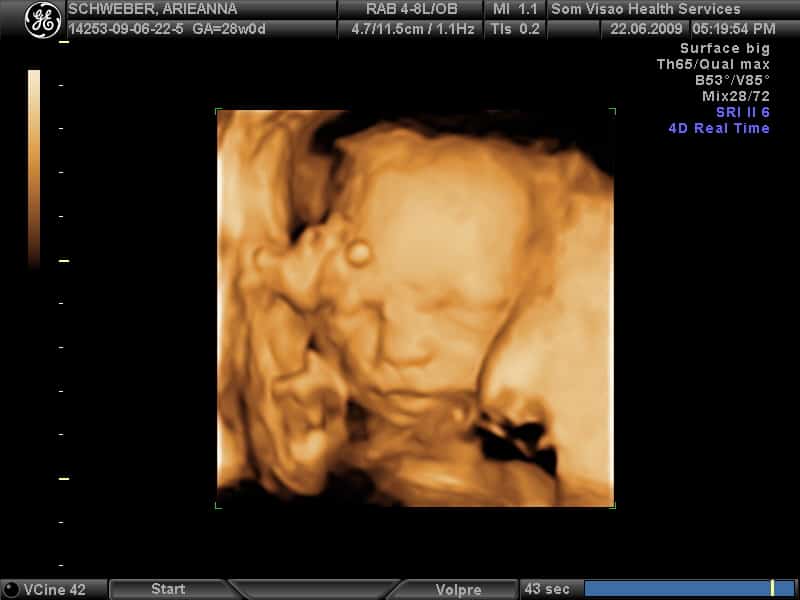Veja o que o ultrassom 3D tem de diferente do ultrassom tradicional