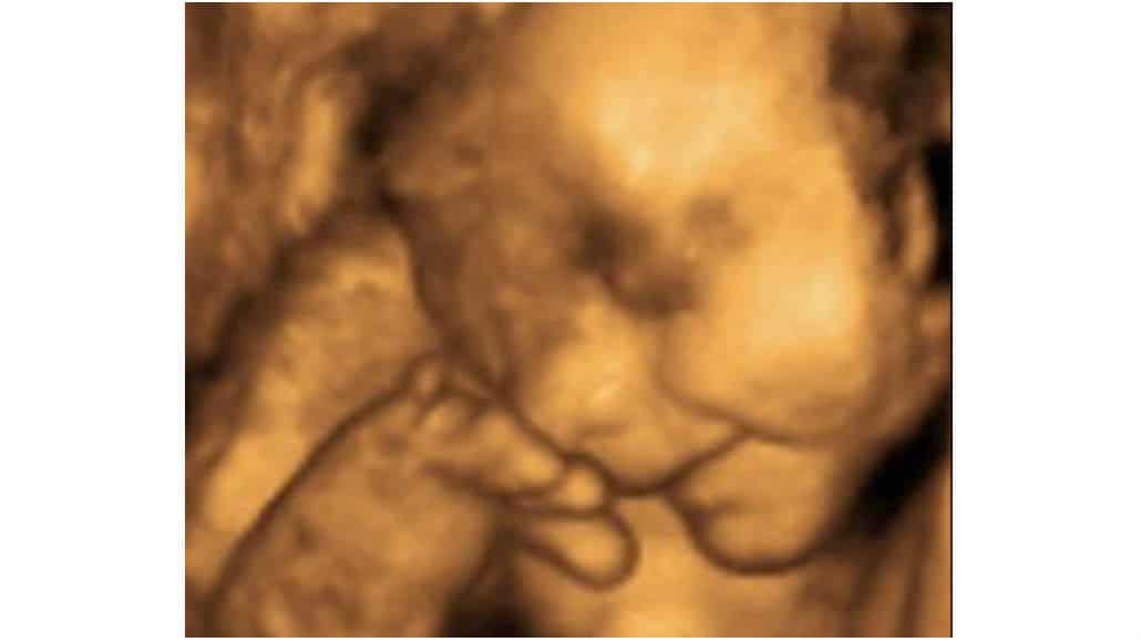 Bebê com pezinho na boca, dentro do útero