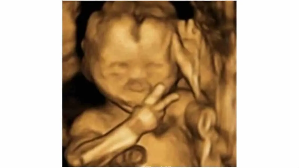Imagem fofa do bebê no útero fazendo paz e amor