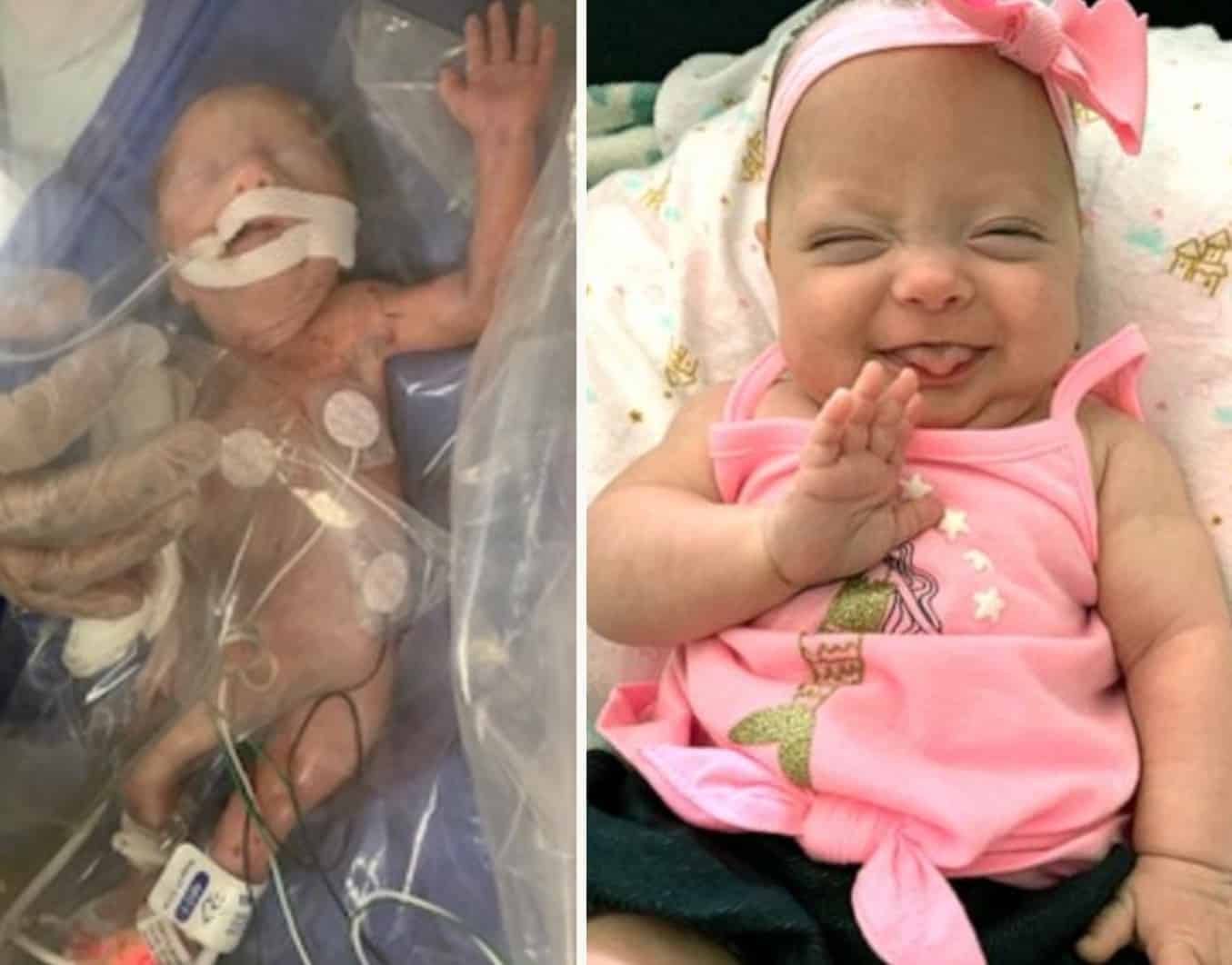 A bebê ficou cerca de 100 dias internada na UTI Neonatal