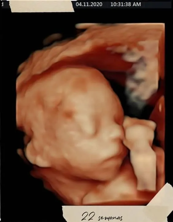 O ultrassom 3D do bebê do cantor Lucas Lucco