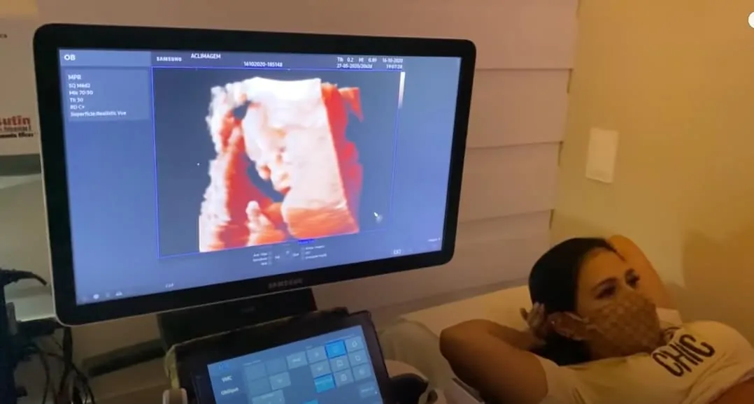 Simone no ultrassom 3D de sua filha