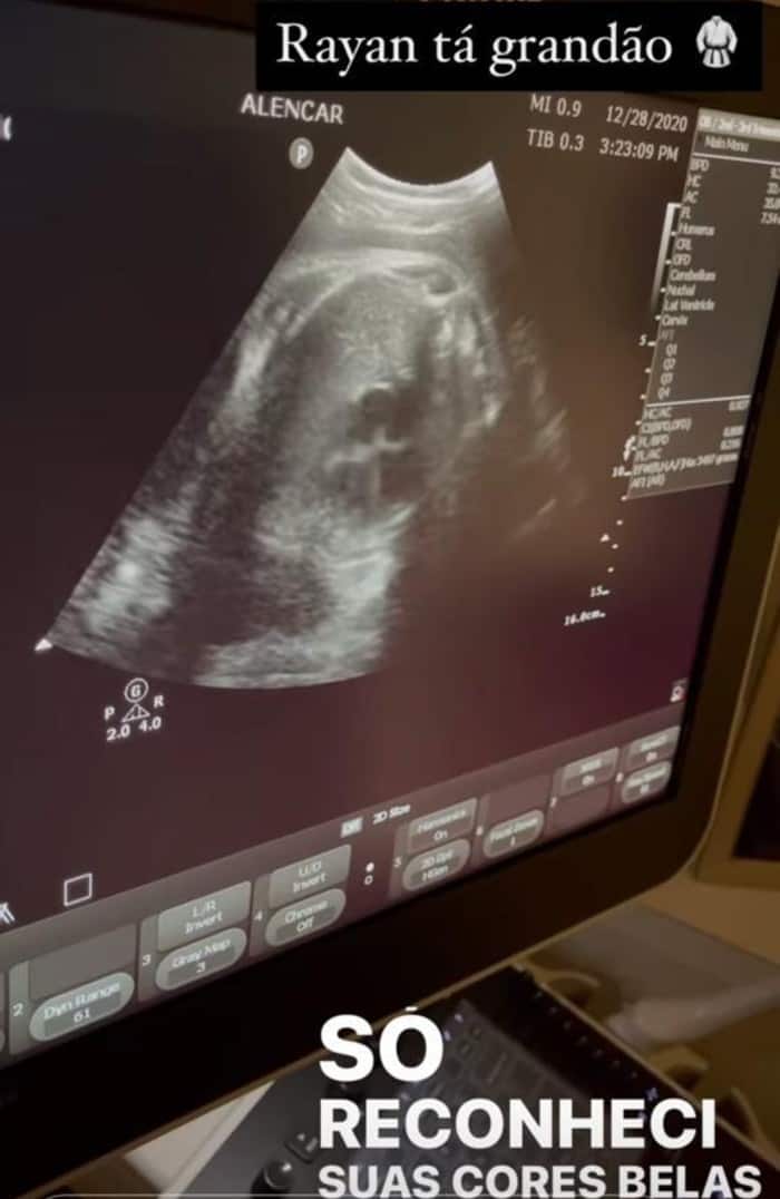 Malvino Salvador e Kyra mostraram o ultrassom do bebê