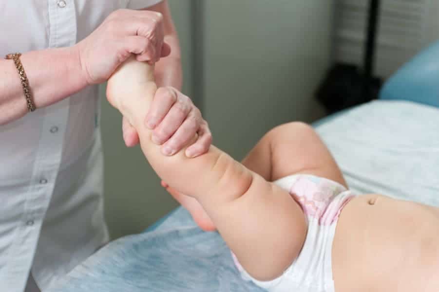 Um bebê hipotônico precisa de acompanhamento médico 