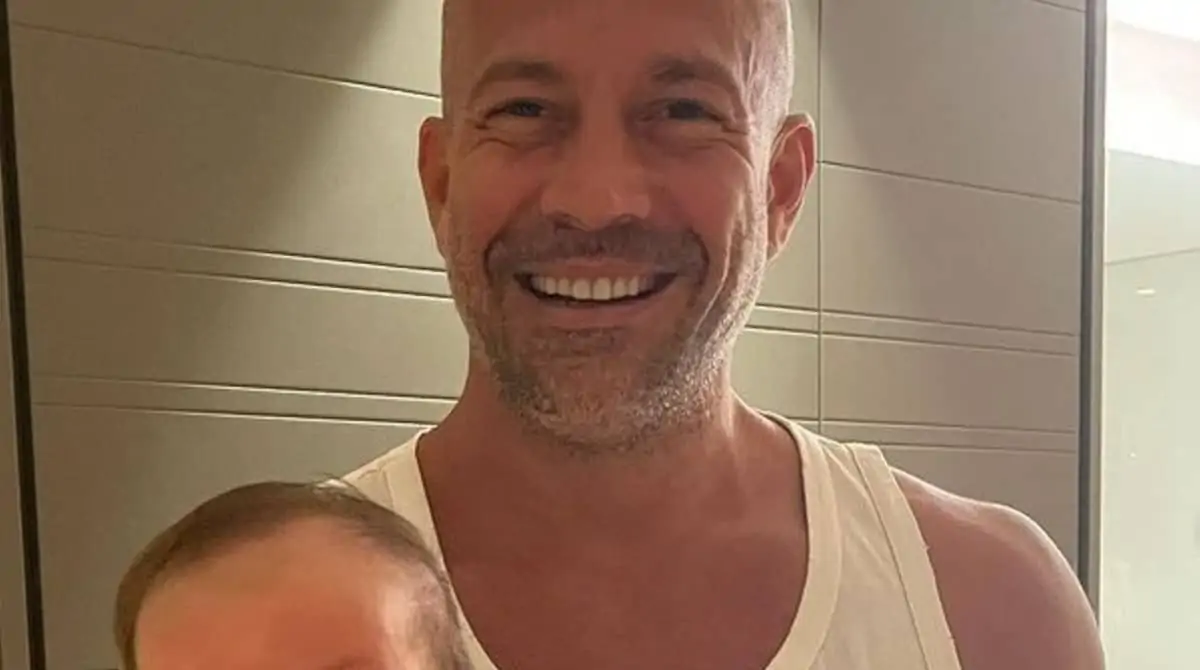 Malvino Salvador posou com seu filho após implante no cabelo