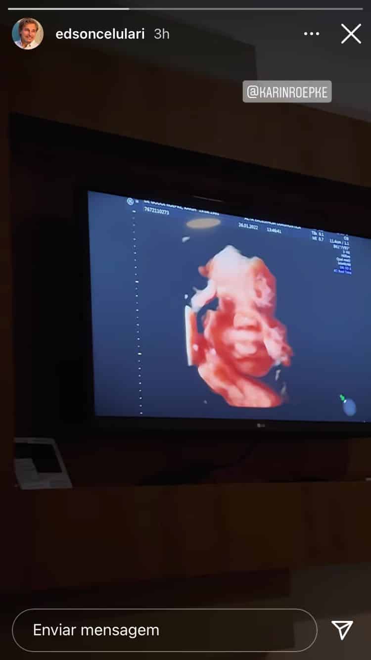 Edson Celulari mostra sua bebê no ultrassom