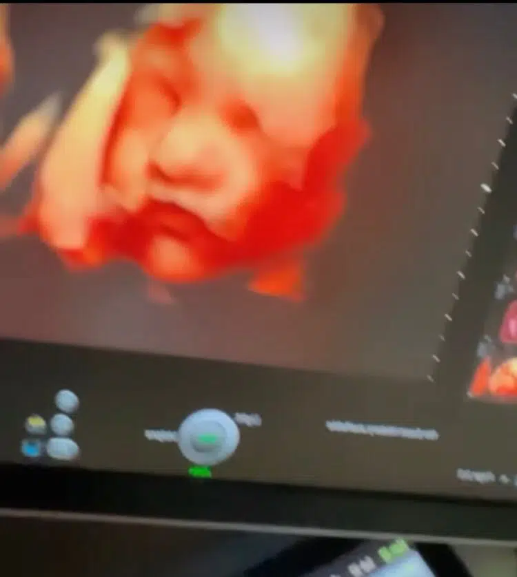 Fabíola Gadelha mostra imagem do rosto da sua bebê