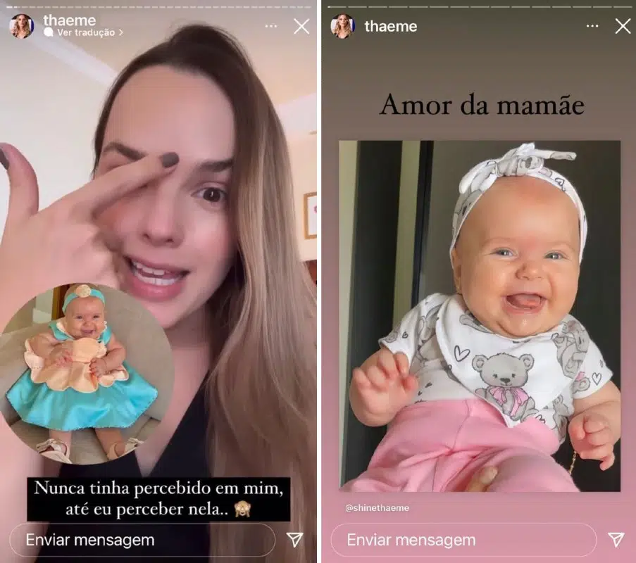 A cantora Thaeme mostrou a manchinha no seu rosto e no de sua bebê