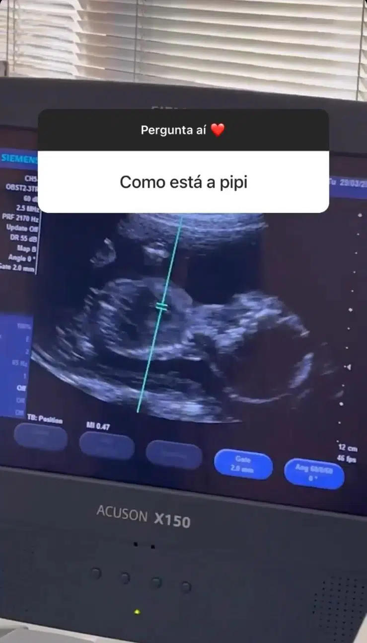Tays Reis e Biel mostram ultrassonografia da bebê