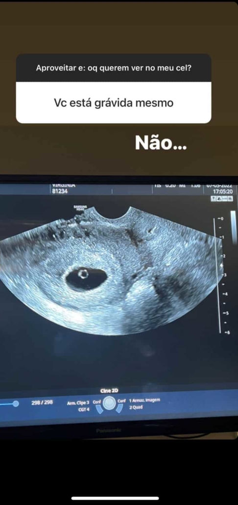 Virginia Fonseca mostra ultrassom da 2ª gravidez