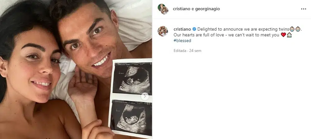 Os papais Cristiano Ronaldo e Georgina Rodríguez quando anunciaram a gravidez