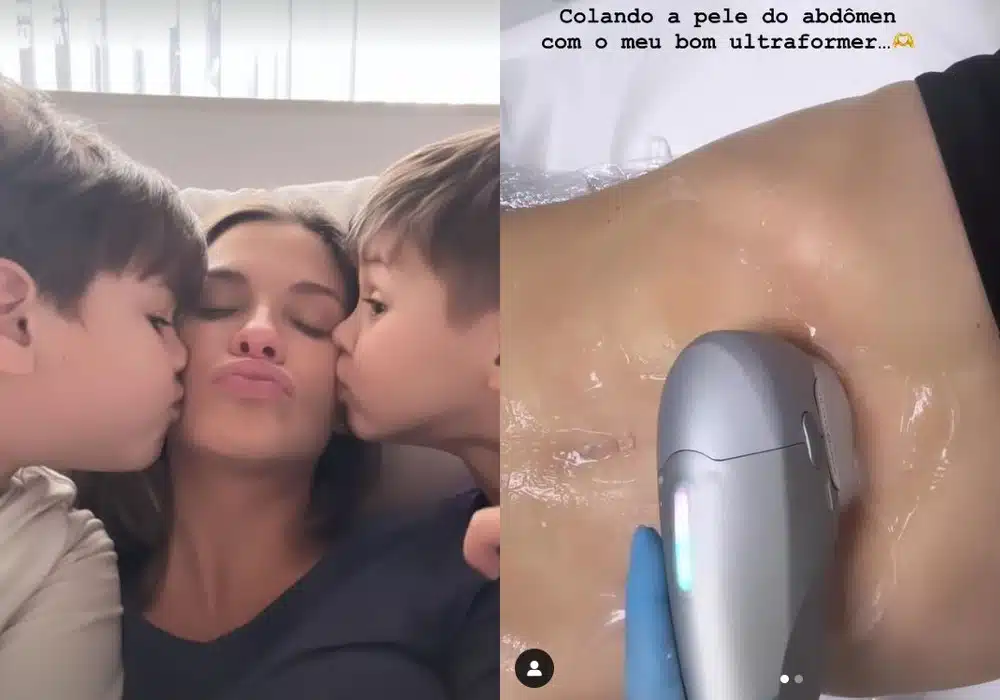 Andressa Suita com os filhos e revelando procedimento