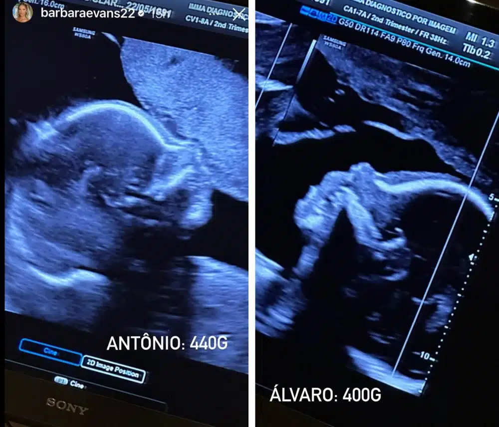 Álvaro e Antônio, bebês gêmeos, da modelo Bárbara Evans